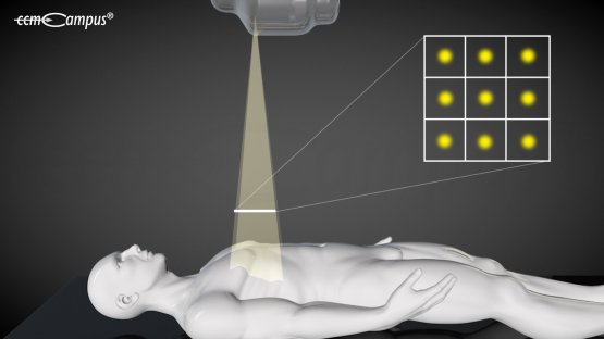Dosis-Flächenprodukt